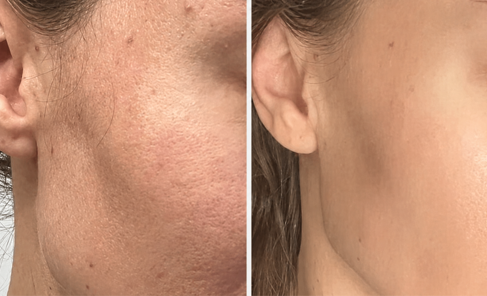 Before and after