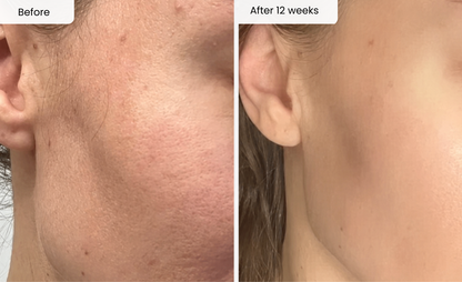 Embrace Ageless Confidence with All-In-One Mineral Sunscreen