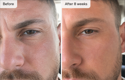 Embrace Ageless Confidence with All-In-One Mineral Sunscreen